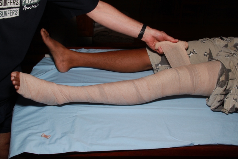 Immobilizing a limb for first aid